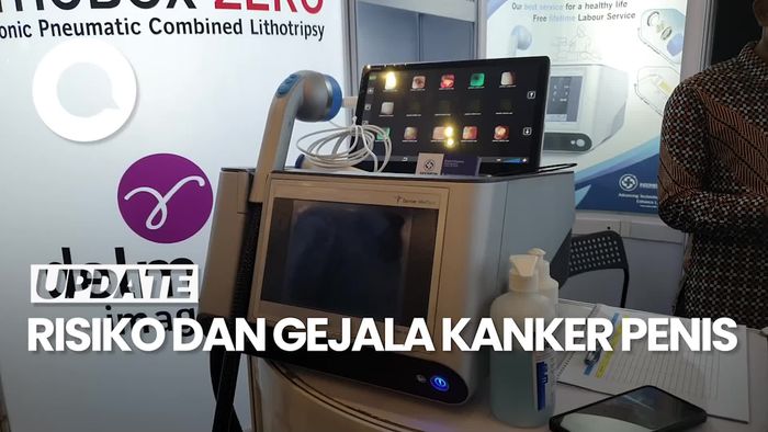 Kenali Risiko Kanker Penis pada Pria Dewasa