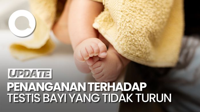 Cara Menangani Kondisi Undescended Testis pada Bayi 