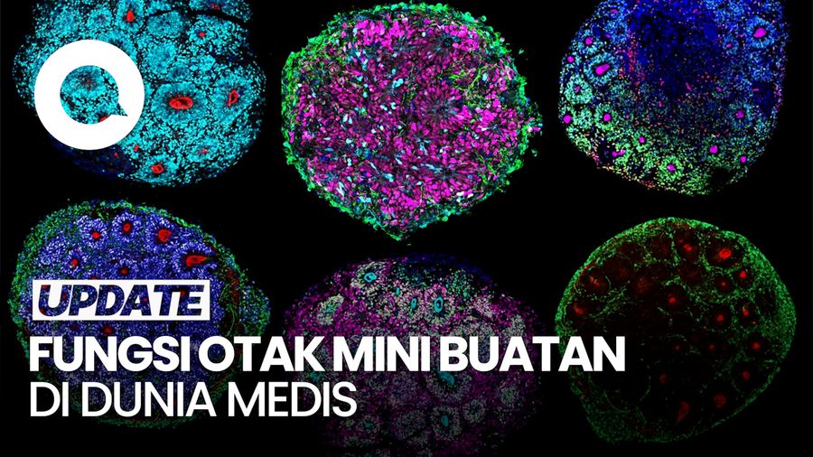 Ilmuwan Ciptakan Otak Mini Pertama dari Sel Manusia 