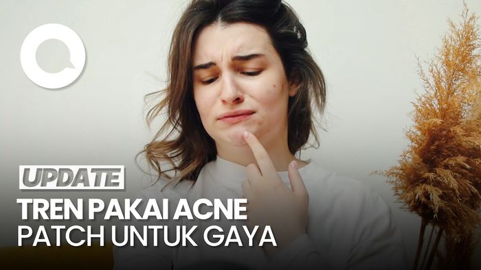 Penggunaan Acne Patch untuk Gaya-gayaan Tak Dianjurkan Dokter