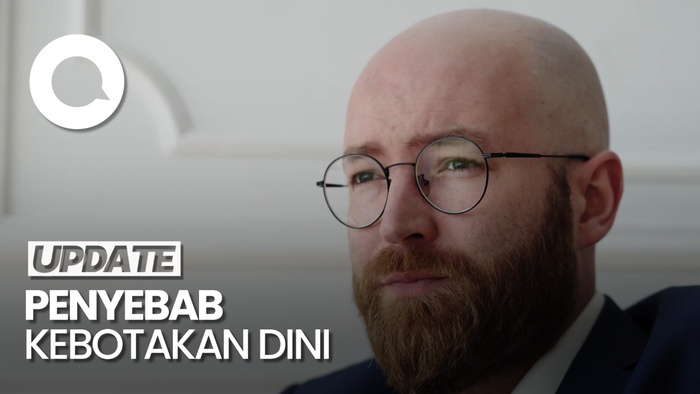 Penyebab Anak Muda Alami Kebotakan