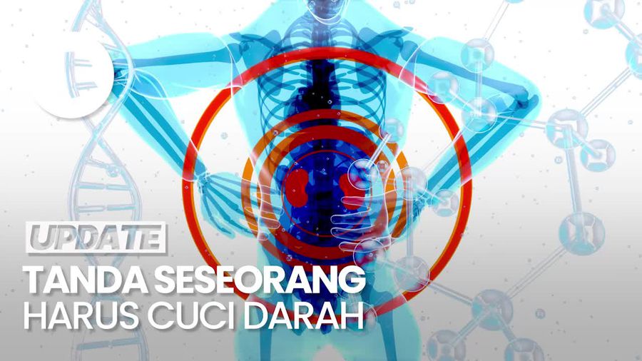 Kenali Gejala Seseorang Harus Lakukan Cuci Darah
