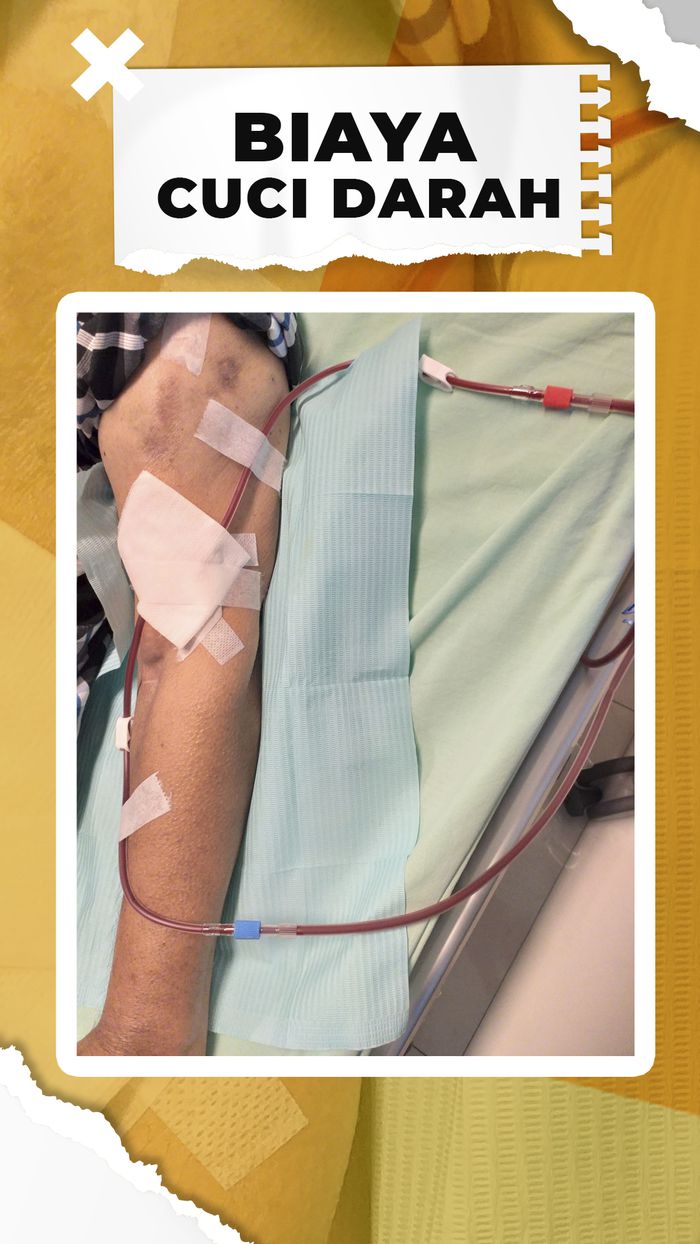 Ditanggung BPJS, Segini Biaya Cuci Darah