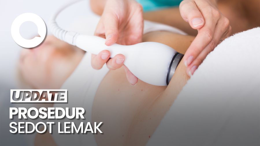 Catat! Yang Mesti Disiapkan Sebelum Melakukan Sedot Lemak