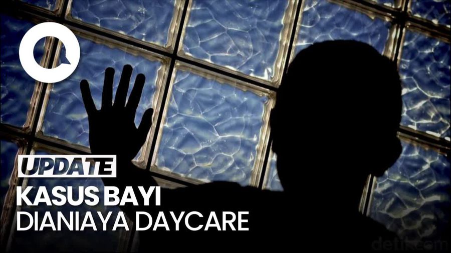 Ayah Korban Penganiayaan Daycare Geram: Kaki Anak Saya Diinjak-Kepala Ditekan
