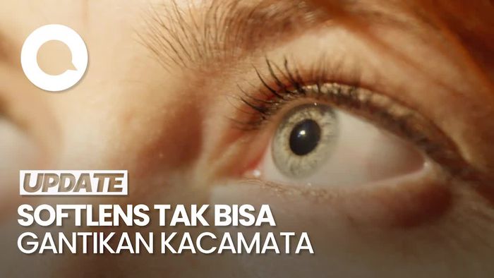 Dokter Spesialis Mata Sebut Softlens Tidak Bisa Gantikan Fungsi Kacamata