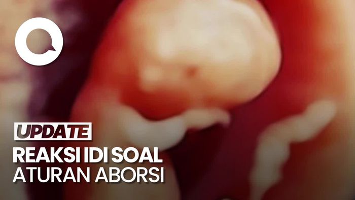 Sejumlah Catatan IDI Terkait Aturan Aborsi