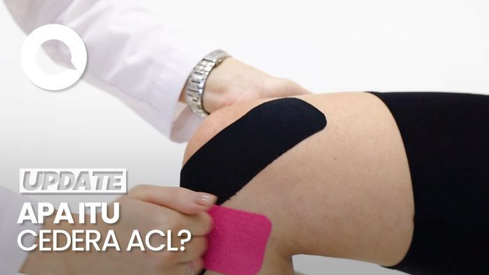 Mengenal ACL, Cedera Lutut yang Dialami Carolina Marin