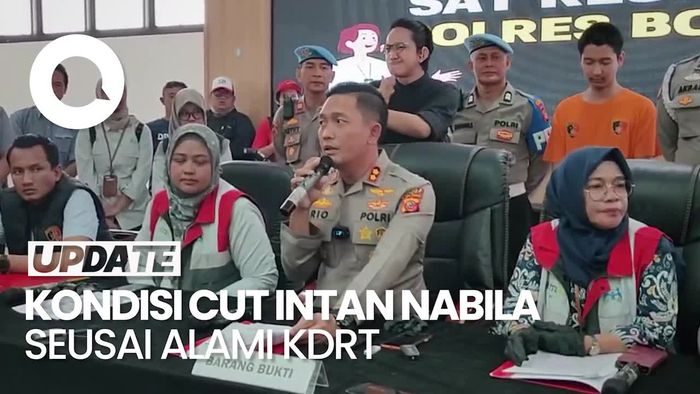 Kondisi Cut Intan Nabila Seusai Alami KDRT: Sangat Trauma-Ada Luka Fisik