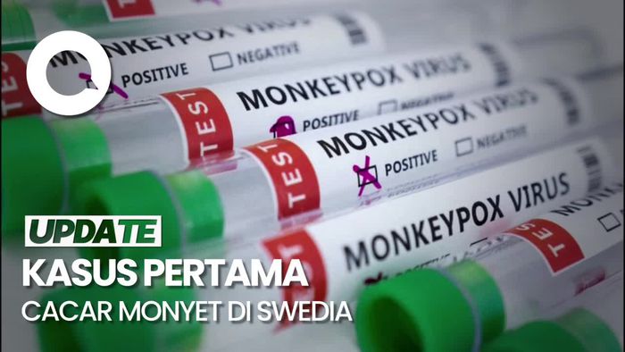 Swedia Catat Kasus Pertama Cacar Monyet Varian Baru yang Lebih Menular