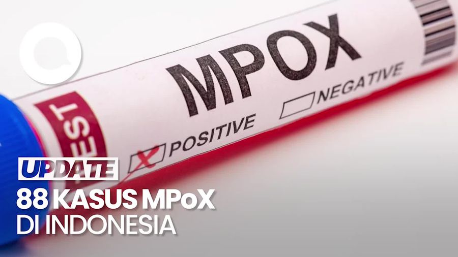 Kemenkes Catat 88 Kasus Mpox di RI, Paling Banyak di Jakarta