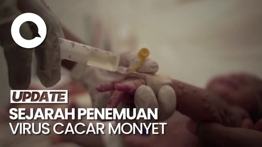 Sejarah Penemuan Mpox hingga Jadi Darurat Kesehatan Masyarakat