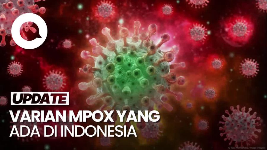 Varian Mpox yang Terdeteksi di Indonesia