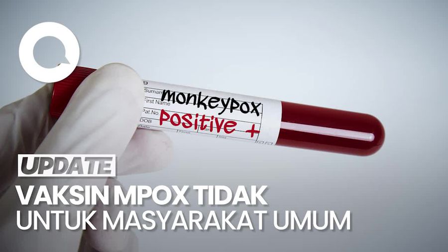 Menkes Sebut Pengobatan-Vaksin Mpox Tersedia, Namun....