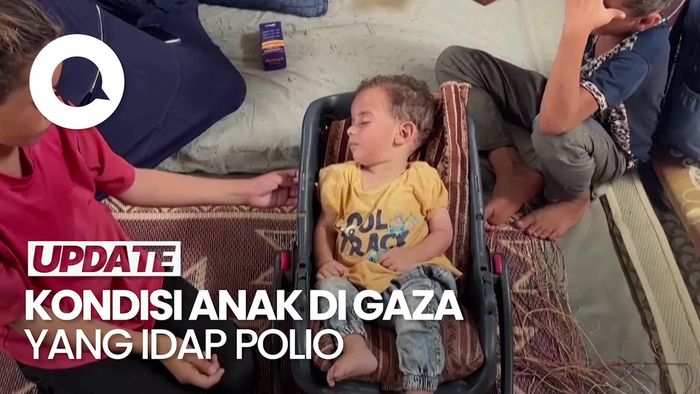 WHO Ungkap Kondisi Anak 10 Bulan di Gaza yang Mengidap Polio