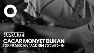 Bantahan Kemenkes soal Narasi Mpox Efek Samping Vaksin Covid-19