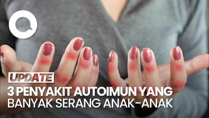 Kenali 3 Jenis Penyakit Autoimun yang Paling Sering Menyerang Anak