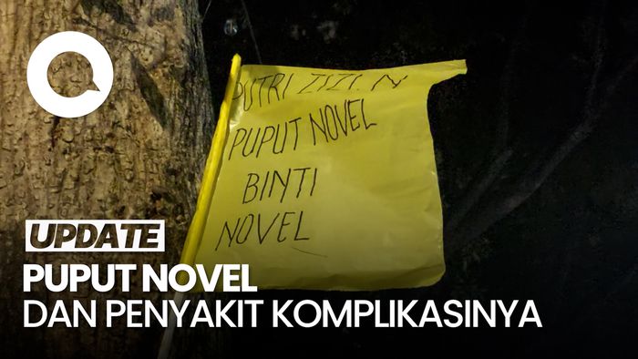 Puput Novel Berpulang Seusai 3 Tahun Berjuang Lawan Kanker Payudara