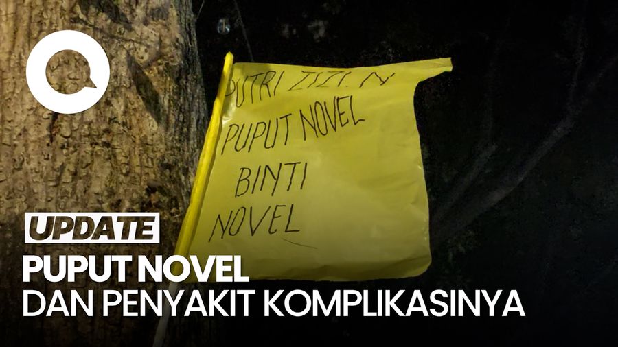 Puput Novel Berpulang Seusai 3 Tahun Berjuang Lawan Kanker Payudara