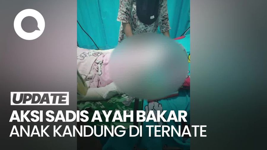 Anak Gadis 13 Tahun Dibakar Ayah Kandungnya Sendiri di Ternate