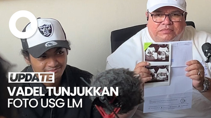 Bantah Hamili LM, Vadel Badjideh Tunjukan Foto USG