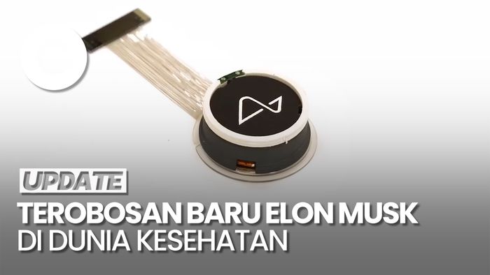 Neuralink Elon Musk Kantongi Izin Lakukan Implan Mata