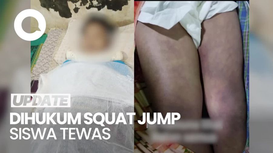 Video: Siswa SMP di Deli Serdang Tewas Seusai Dihukum Squat Jump 100 Kali