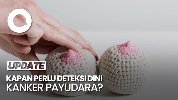 Video: Anjuran Dokter soal Waktu Terbaik untuk Deteksi Dini Kanker Payudara