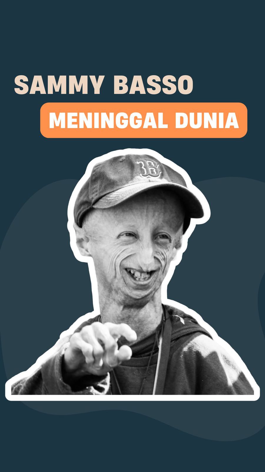 Video: Sosok Sammy Basso, Pengidap Penyakit Genetik Langka Meninggal Dunia