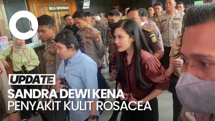Video: Sandra Dewi Ungkap Kena Penyakit Kulit Rosacea Seumur Hidup