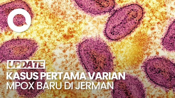 Video: Jerman Identifikasi Kasus Pertama Varian Mpox Baru
