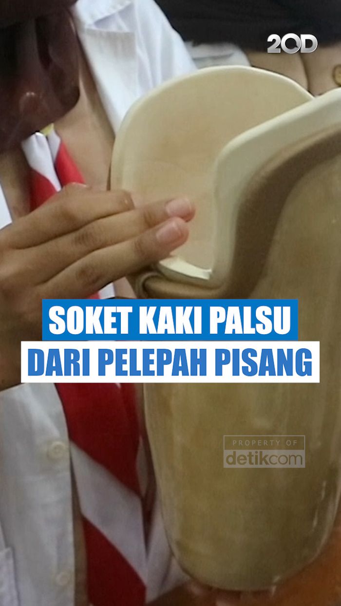 Video: Siswa SMA Raih Emas Berkat Soket Kaki Palsu dari Pelepah Pisang