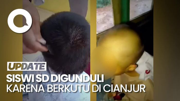 Video Viral Siswi SD Berkutu Digunduli Tanpa Sepengetahuan Orang Tua