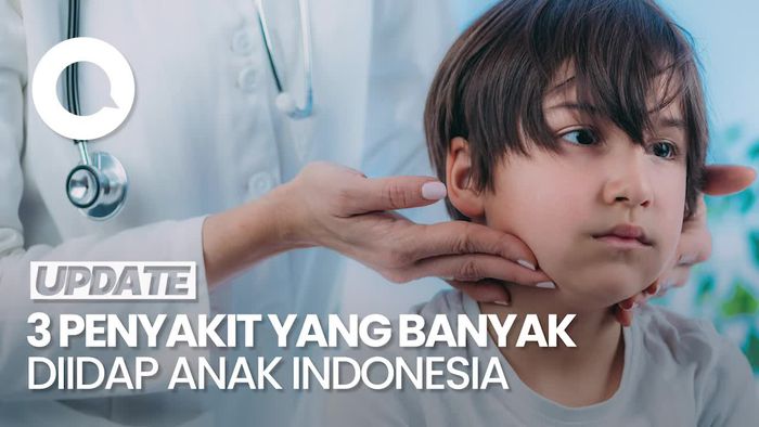 Video: Gondongan Serang Anak Indonesia, Kasus Lebih dari 6 Ribu