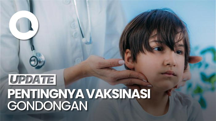Video: Anak Masih Bisa Gondongan Seusai Divaksin, tapi Gejala Lebih Ringan