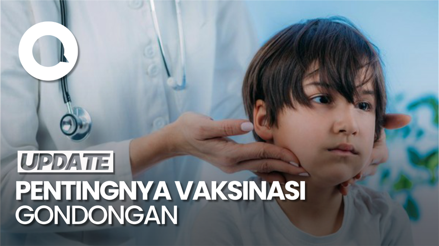 Video: Anak Masih Bisa Gondongan Seusai Divaksin, tapi Gejala Lebih Ringan