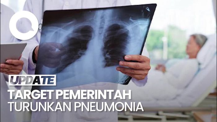 Video: Pemerintah Targetkan Kematian Balita Akibat Pneumonia Turun di 2030
