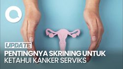  Kanker Serviks Bisa Disembuhkan, Vaksinasi-Skrining Penting Dilakukan