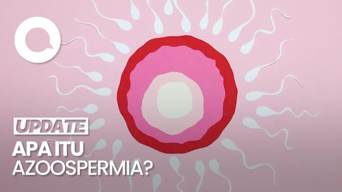 Video: Dokter Sebut 50% Pria Indonesia Idap Azoospermia, Apa Itu?