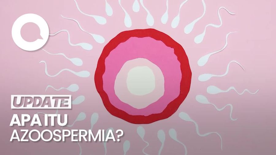 Video: Dokter Sebut 50% Pria Indonesia Idap Azoospermia, Apa Itu?