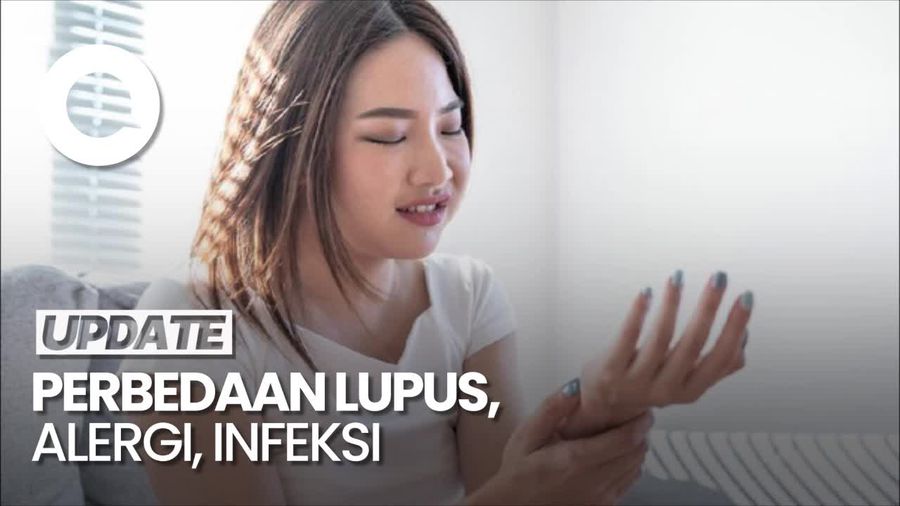 Video: Simak Yuk Bedanya Lupus, Alergi, dan Infeksi!