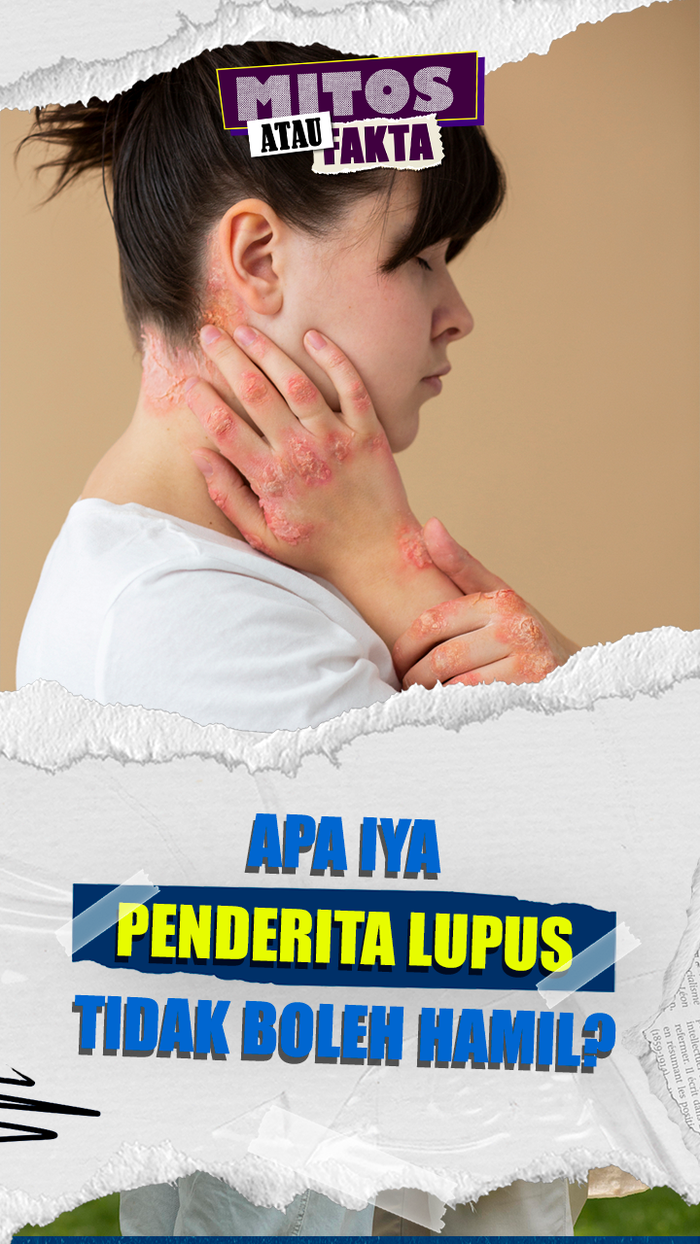 Video Mitos atau Fakta: Penderita Lupus yang Hamil Berpotensi Alami Komplikasi