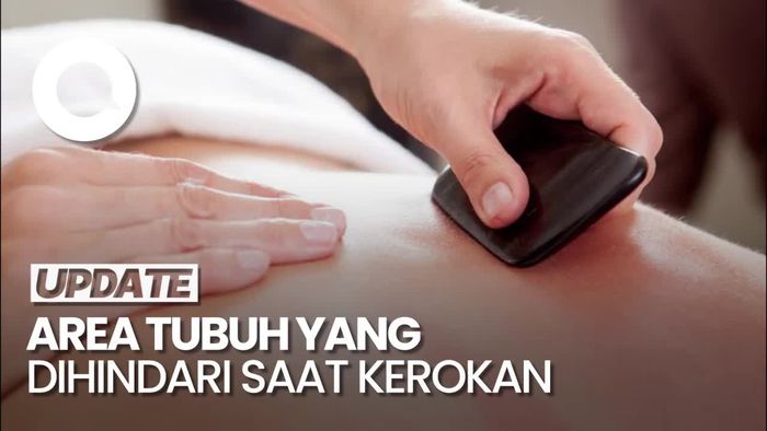 Video: Detikers, Hindari Kerokan di Area Tubuh Ini!