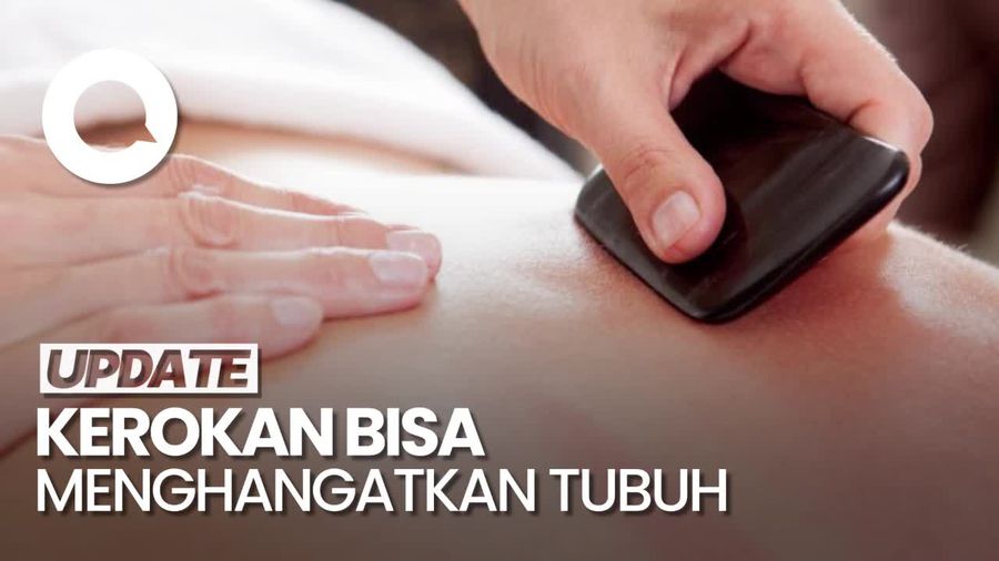 Video Penjelasan Medis di Balik Sensasi Hangat Kerokan