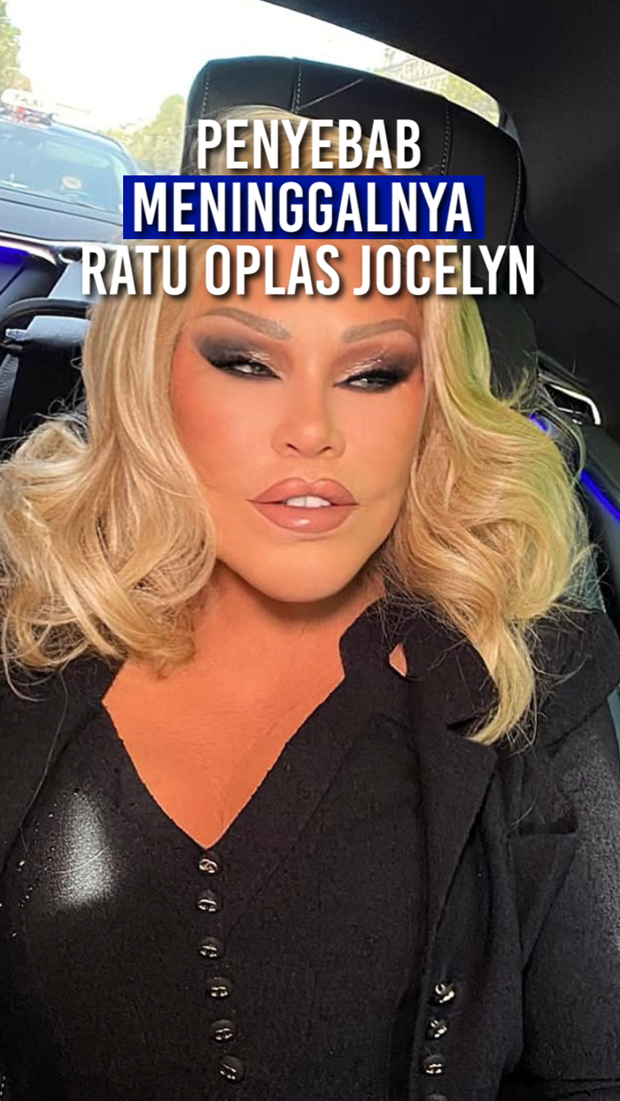 Video: Meninggalnya Ratu Oplas Jocelyn Wildenstein
