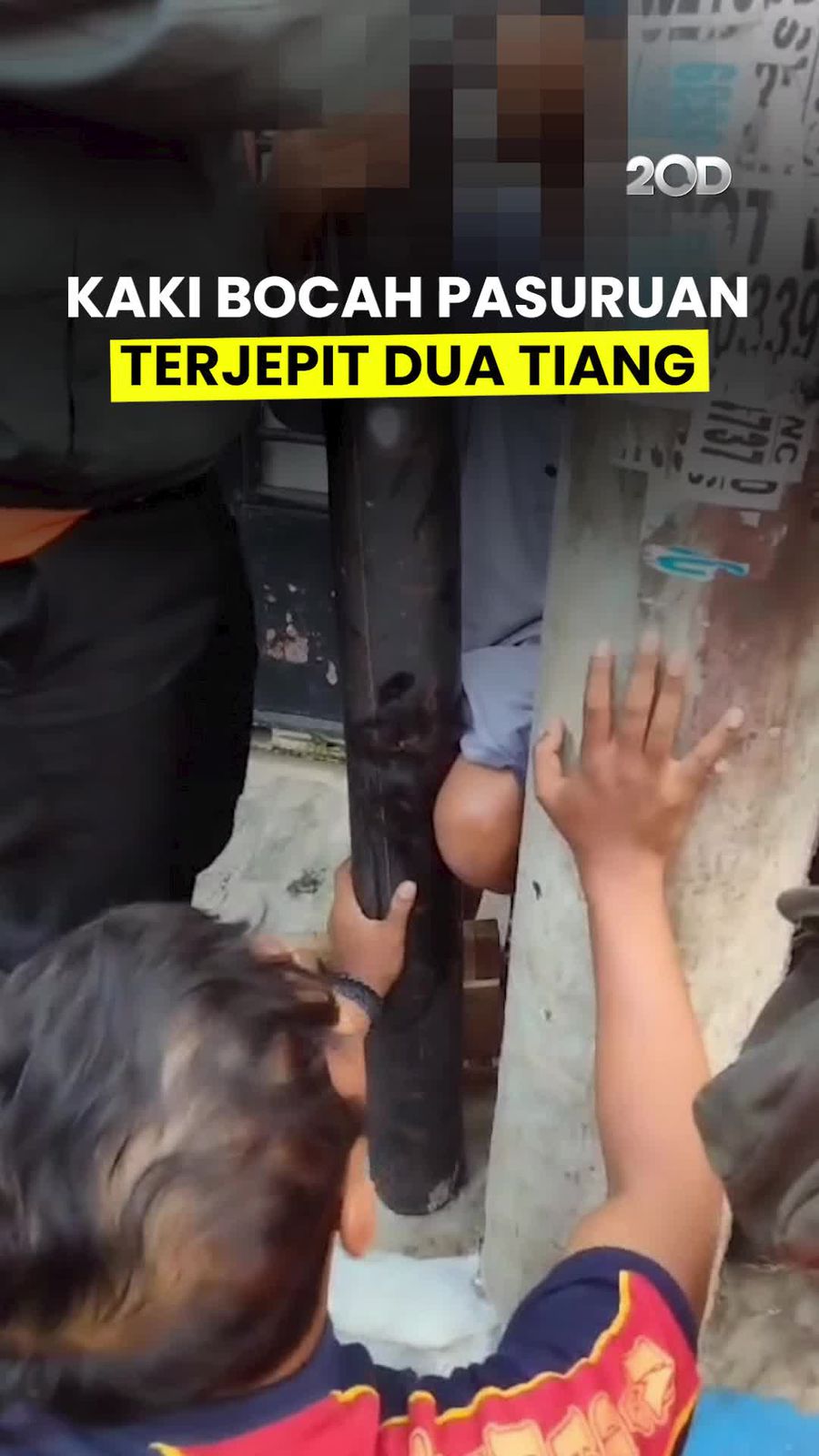 Video Kaki Bocah Nyangkut di Antara Dua Tiang, BPBD Turun Tangan