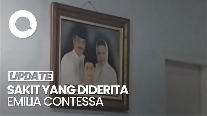 Video: Emilia Contessa Meninggal Usai Idap Diabetes dan Gagal Jantung