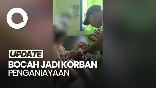 Video: Keji! Bocah di Sumut Dianiaya Keluarga hingga Cacat