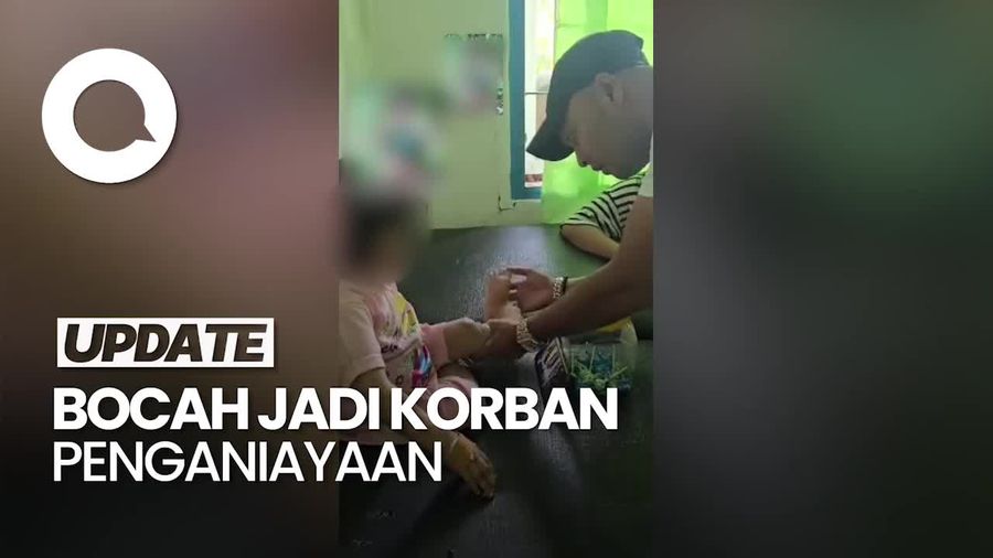 Video: Keji! Bocah di Sumut Dianiaya Keluarga hingga Cacat