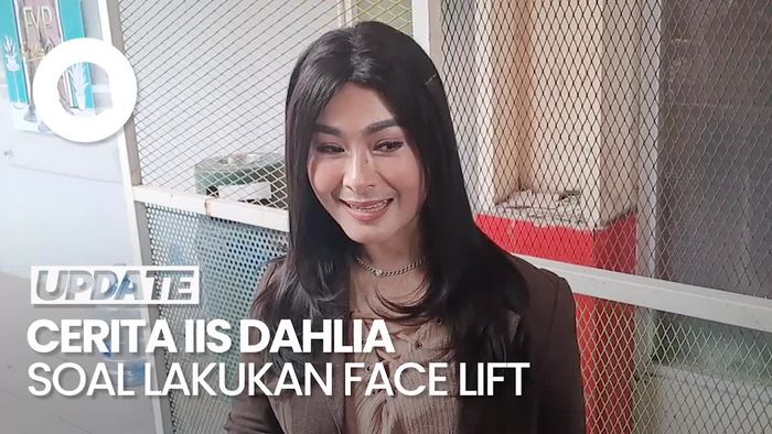 Video Alasan Iis Dahlia Pilih Lakukan Face Lift: Biar Nggak Kerutan Aja